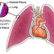 Illustration for article titled Emphysema Can Kill You Because Planes Fly